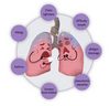 Load image into Gallery viewer, Organic Herbal Lung Cleanse Repair Nasal Spray | BUY 1 GET 2